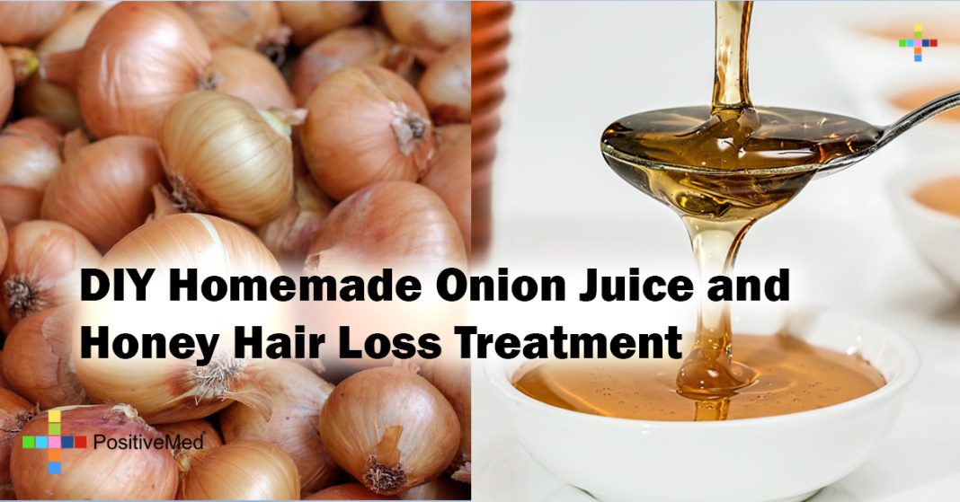 DIY Homemade Onion Juice and Honey Hair Loss Treatment