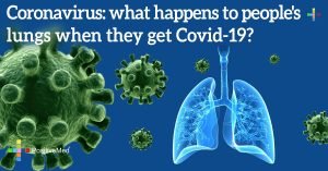 Coronavirus: What Happens to People's Lungs When They Get Covid-19?
