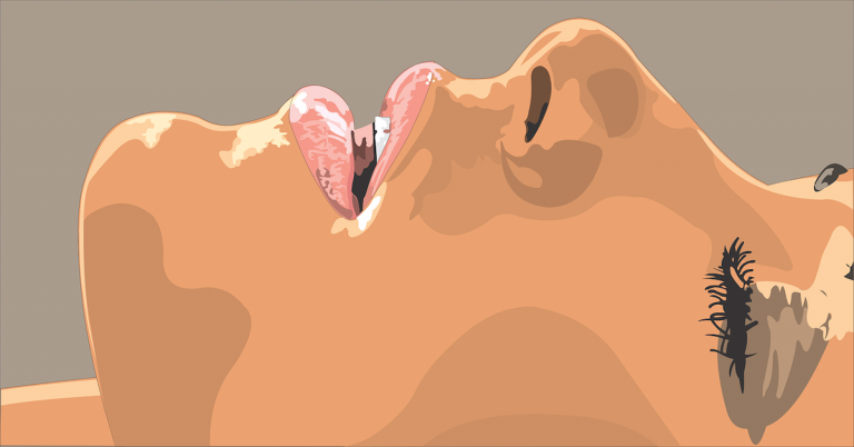 Tongue Fat Could Be Causing Your Miserable Sleep Apnea Tongue Fat Could Be Causing Your Miserable Sleep Apnea