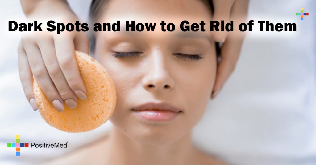 Dark Spots and How to Get Rid of Them