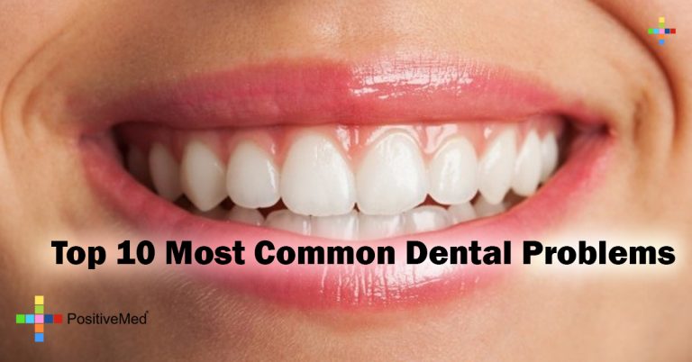 Top 10 Most Common Dental Problems