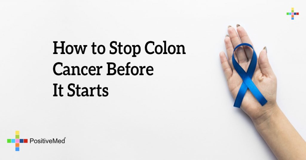 How to Stop Colon Cancer Before It Starts