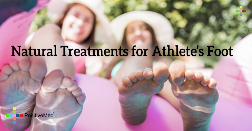 Natural Treatments for Athlete's Foot