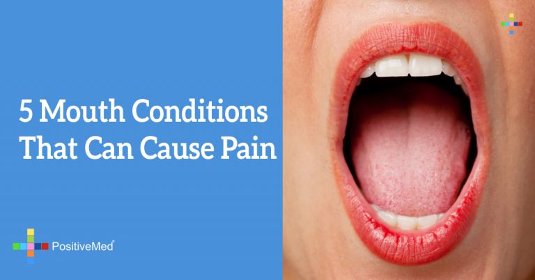 5 Mouth Conditions That Can Cause Pain 5 Mouth Conditions That Can Cause Pain