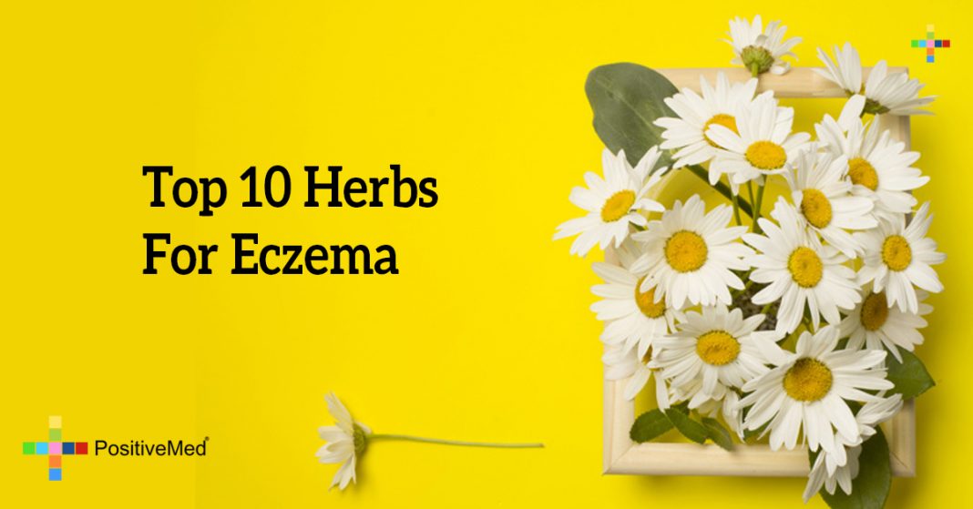Top 10 Herbs For Eczema