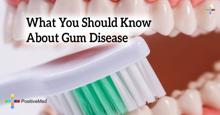 What You Should Know About Gum Disease What You Should Know About Gum Disease
