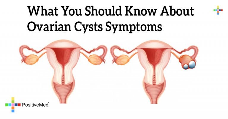 What You Should Know About Ovarian Cysts Symptoms
