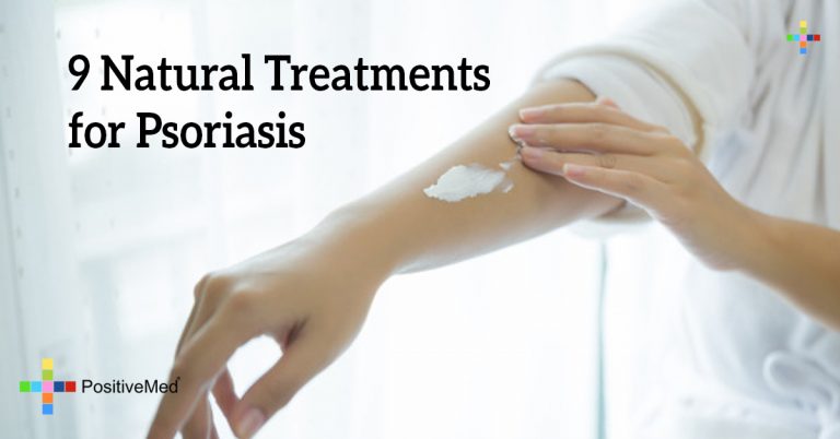 9 Natural Treatments for Psoriasis 9 Natural Treatments for Psoriasis