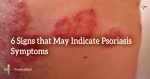 6-Signs-that-May-Indicate-Psoriasis-Symptoms