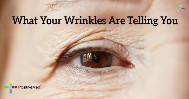 What Your Wrinkles Are Telling You