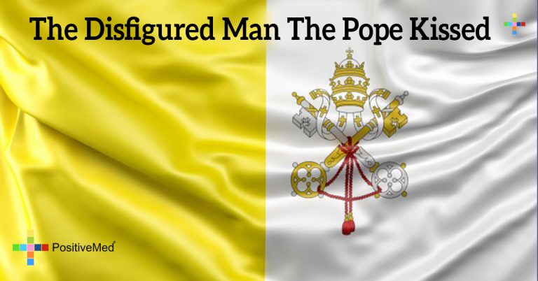 The disfigured man the Pope kissed The disfigured man the Pope kissed