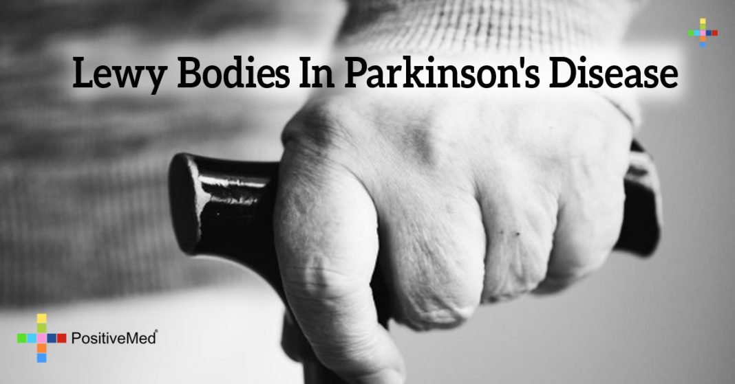 Lewy Bodies in Parkinson's Disease