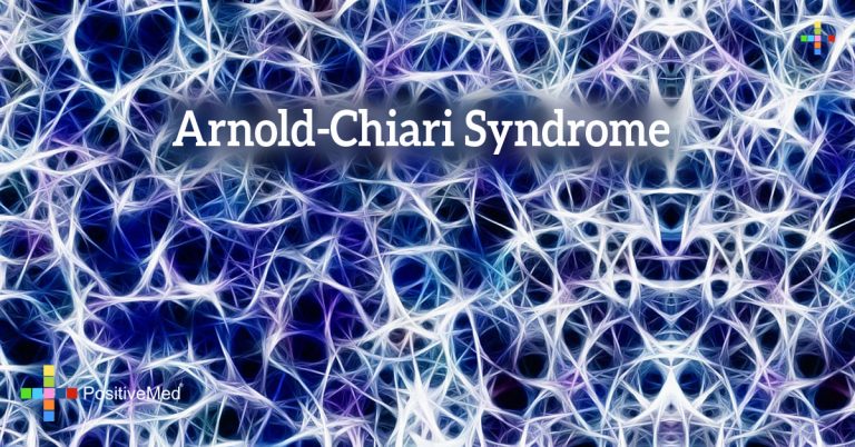 Arnold-Chiari Syndrome
