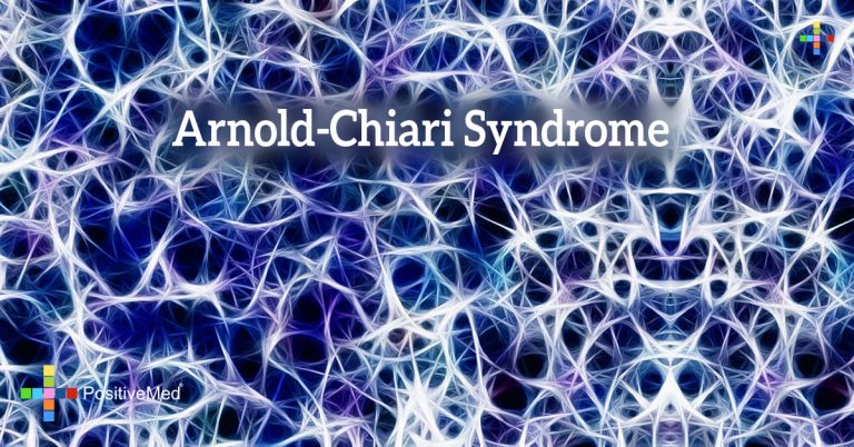 Arnold-Chiari Syndrome Arnold-Chiari Syndrome