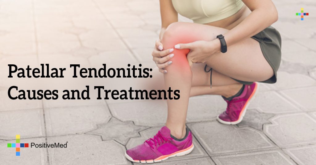Patellar Tendonitis: Causes and Treatments