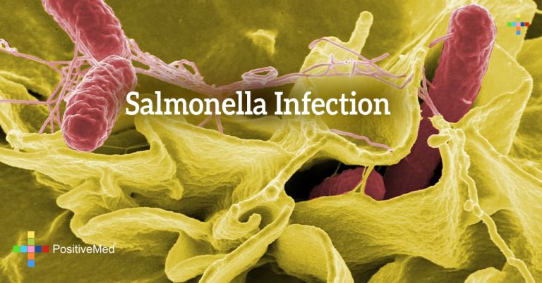 Salmonella Infection Salmonella Infection