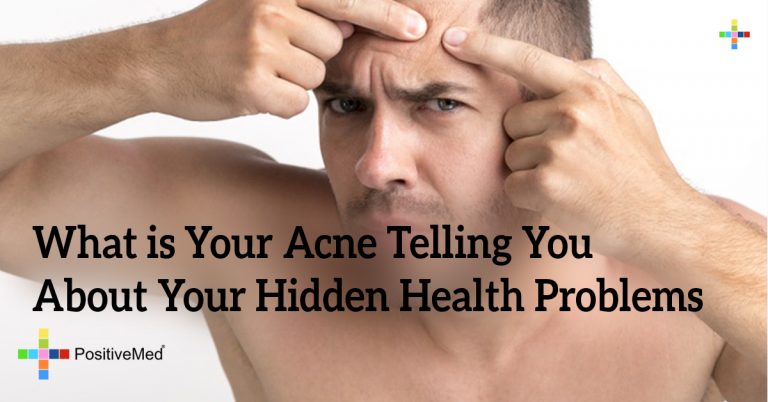What is Your Acne Telling You About Your Hidden Health Problems