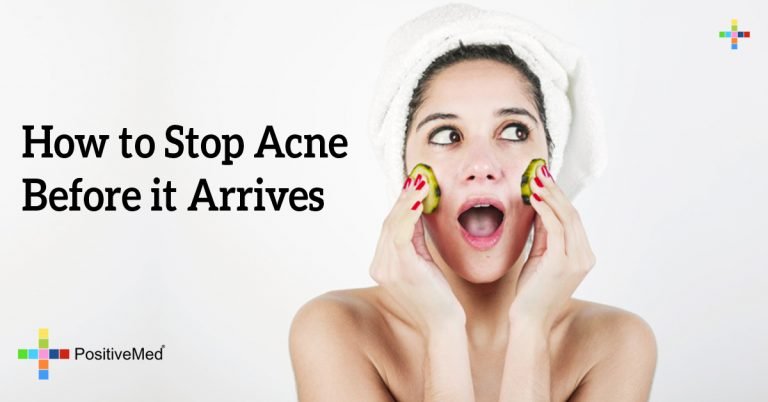 How to Stop Acne Before it Arrives How to Stop Acne Before it Arrives