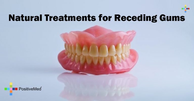 Natural Treatments for Receding Gums