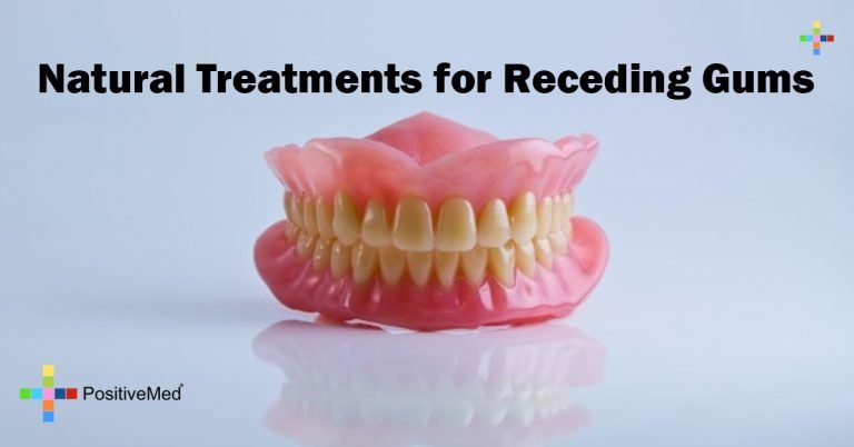 Natural Treatments for Receding Gums Natural Treatments for Receding Gums