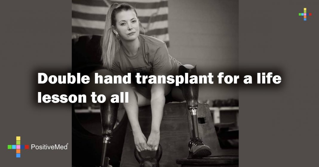 Double hand transplant for a life lesson to all