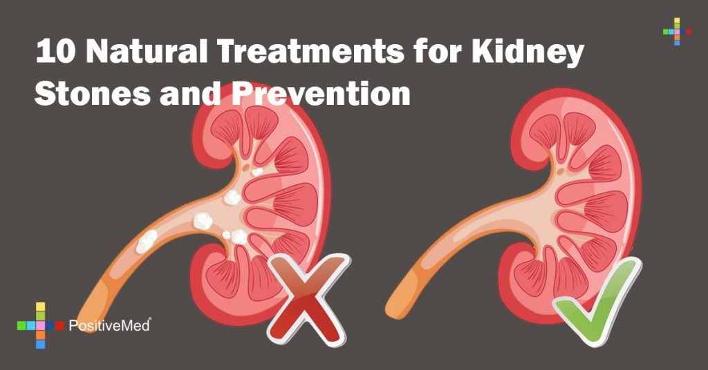 10 Natural Treatments for Kidney Stones and Prevention