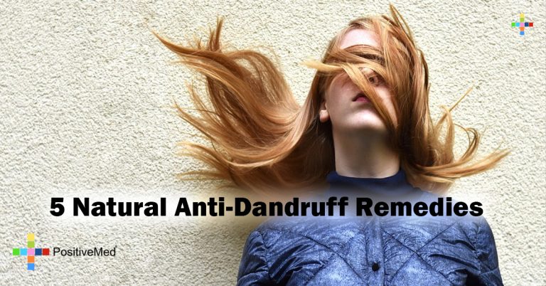 5 Natural Anti-Dandruff Remedies 5 Natural Anti-Dandruff Remedies