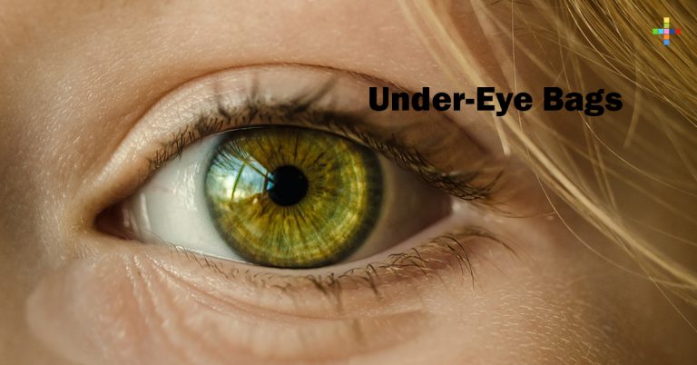 Under-Eye Bags Under-Eye Bags