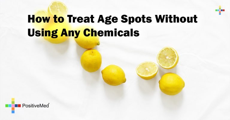 How to Treat Age Spots Without Using Any Chemicals