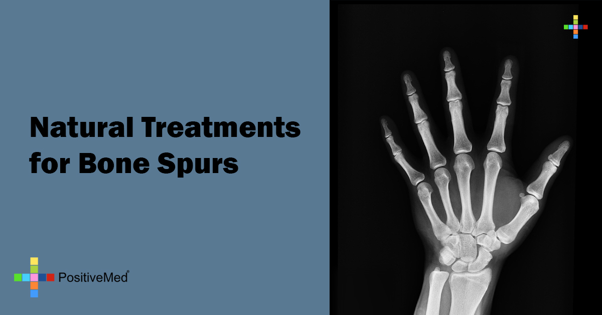 natural treatments for bone spurs