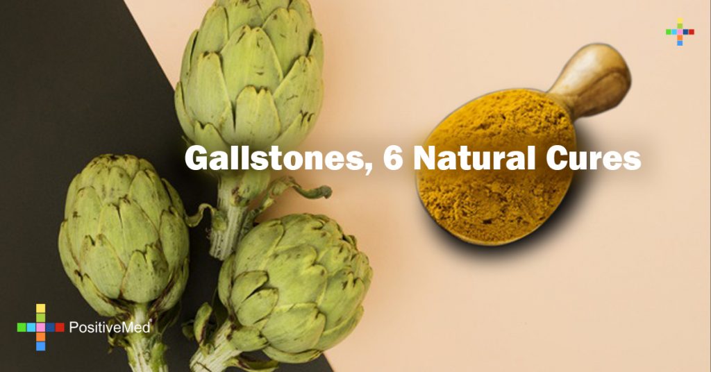 Gallstones, 6 Natural Cures