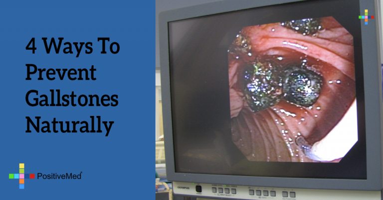 4 Ways To Prevent Gallstones Naturally 4 Ways To Prevent Gallstones Naturally