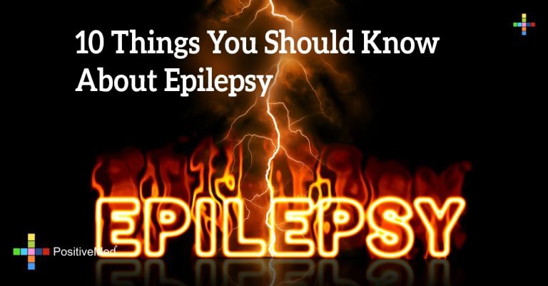 10 Things you should Know about Epilepsy 10 Things you should Know about Epilepsy