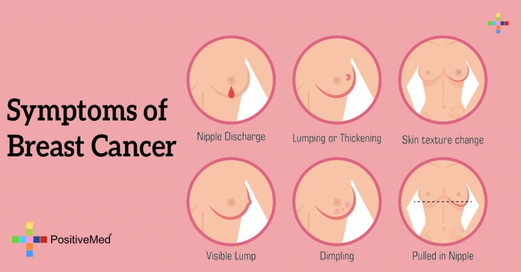 Symptoms of Breast Cancer