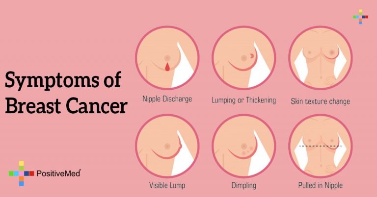 Symptoms of Breast Cancer