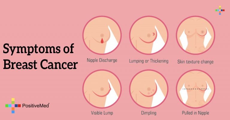 Symptoms of Breast Cancer Symptoms of Breast Cancer