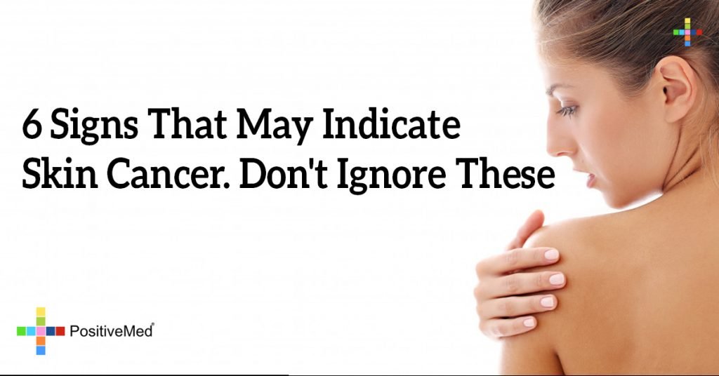 6 Signs That May Indicate Skin Cancer. Don't Ignore These