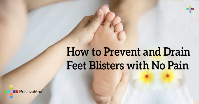 How to Prevent and Drain Feet Blisters with No Pain How to Prevent and Drain Feet Blisters with No Pain