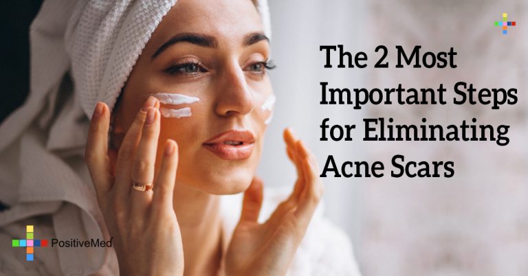 The 2 Most Important Steps for Eliminating Acne Scars The 2 Most Important Steps for Eliminating Acne Scars