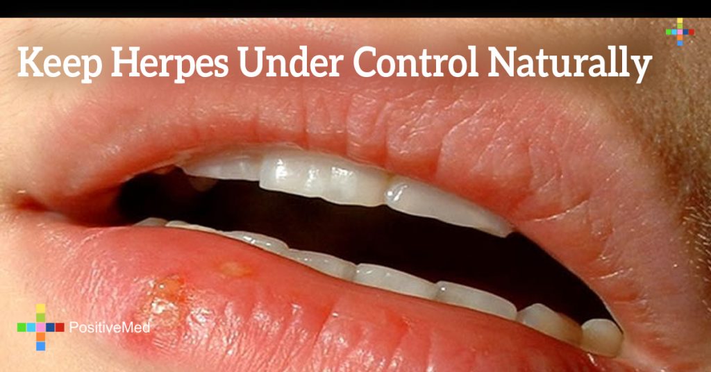 Keep Herpes under Control Naturally