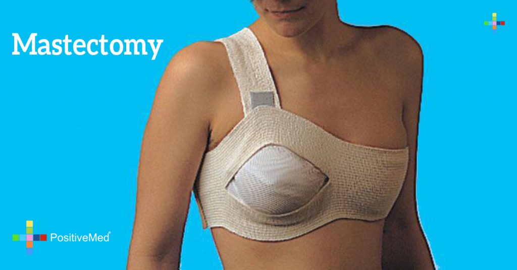 Mastectomy