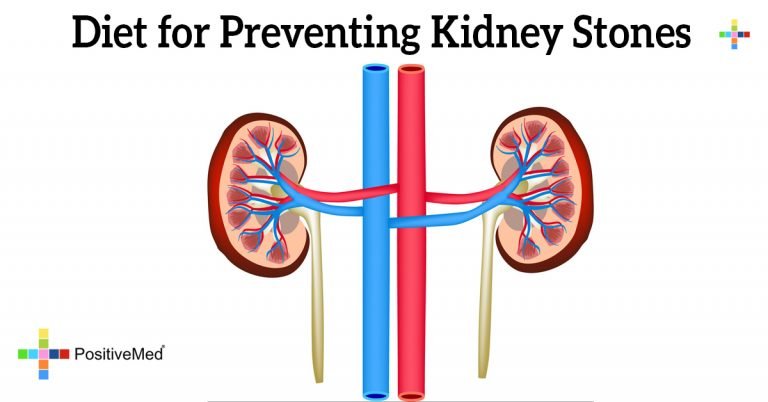 Diet for Preventing Kidney Stones