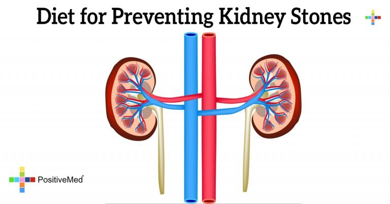 Diet for Preventing Kidney Stones Diet for Preventing Kidney Stones