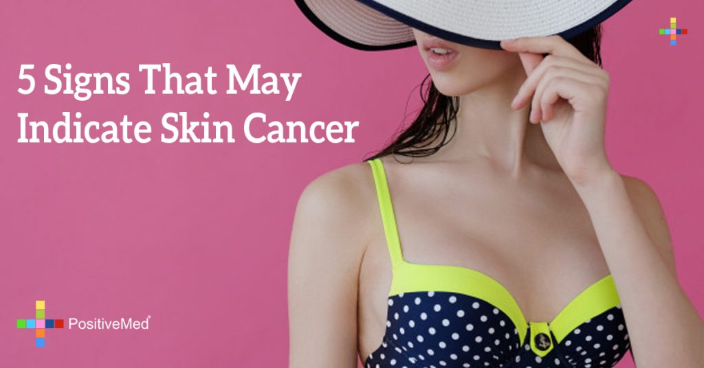 5 Signs That May Indicate Skin Cancer