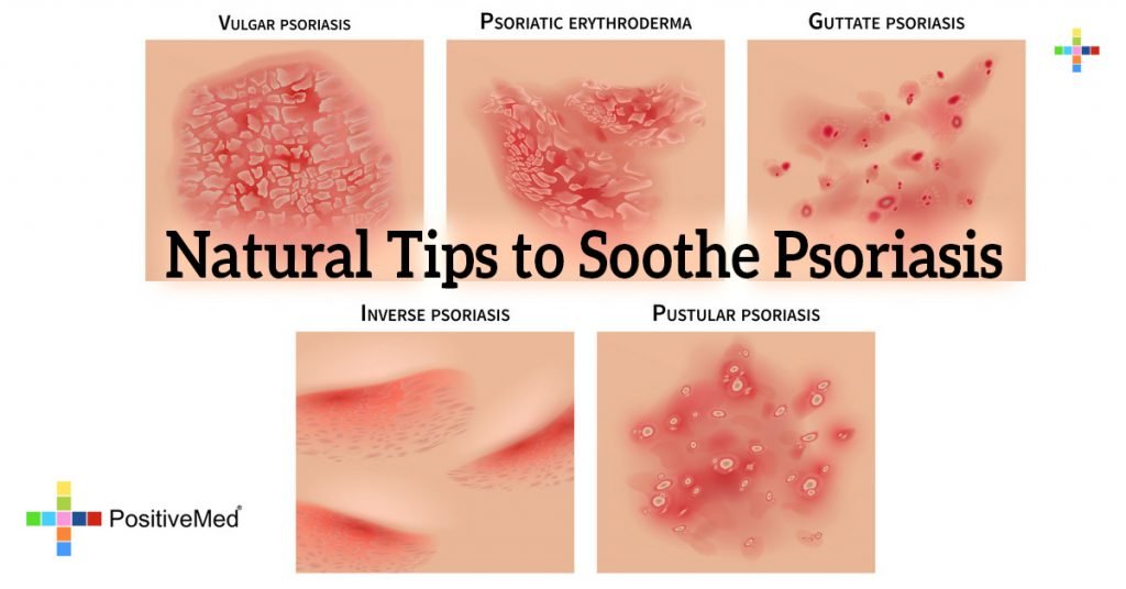 Natural Tips to Soothe Psoriasis