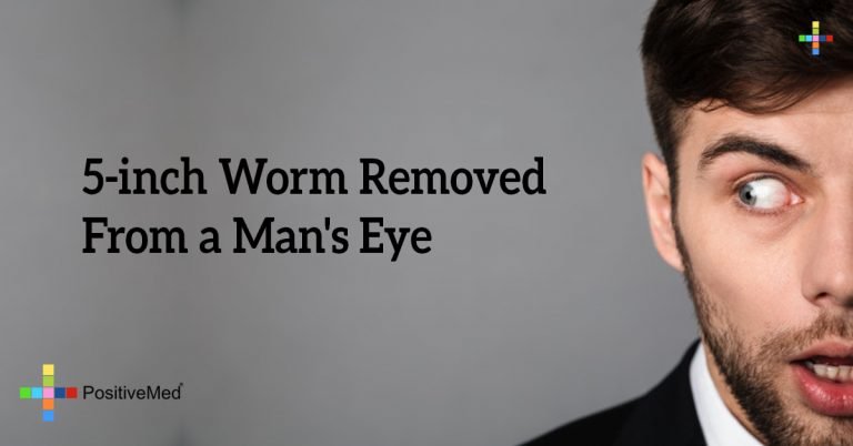 5-inch Worm Removed From a Man’s Eye 5-inch Worm Removed From a Man’s Eye
