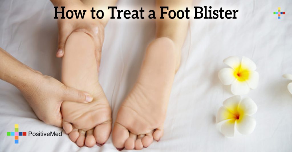 How to Treat a Foot Blister