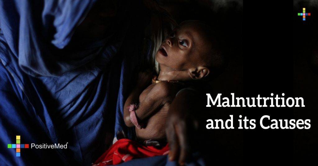 Malnutrition and its Causes
