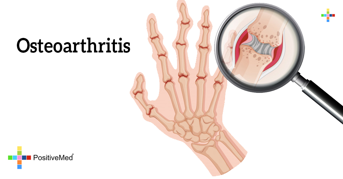 Osteoarthritis