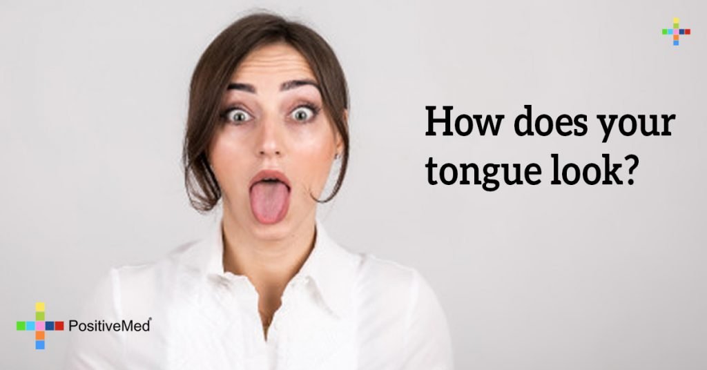 How does your tongue look?
